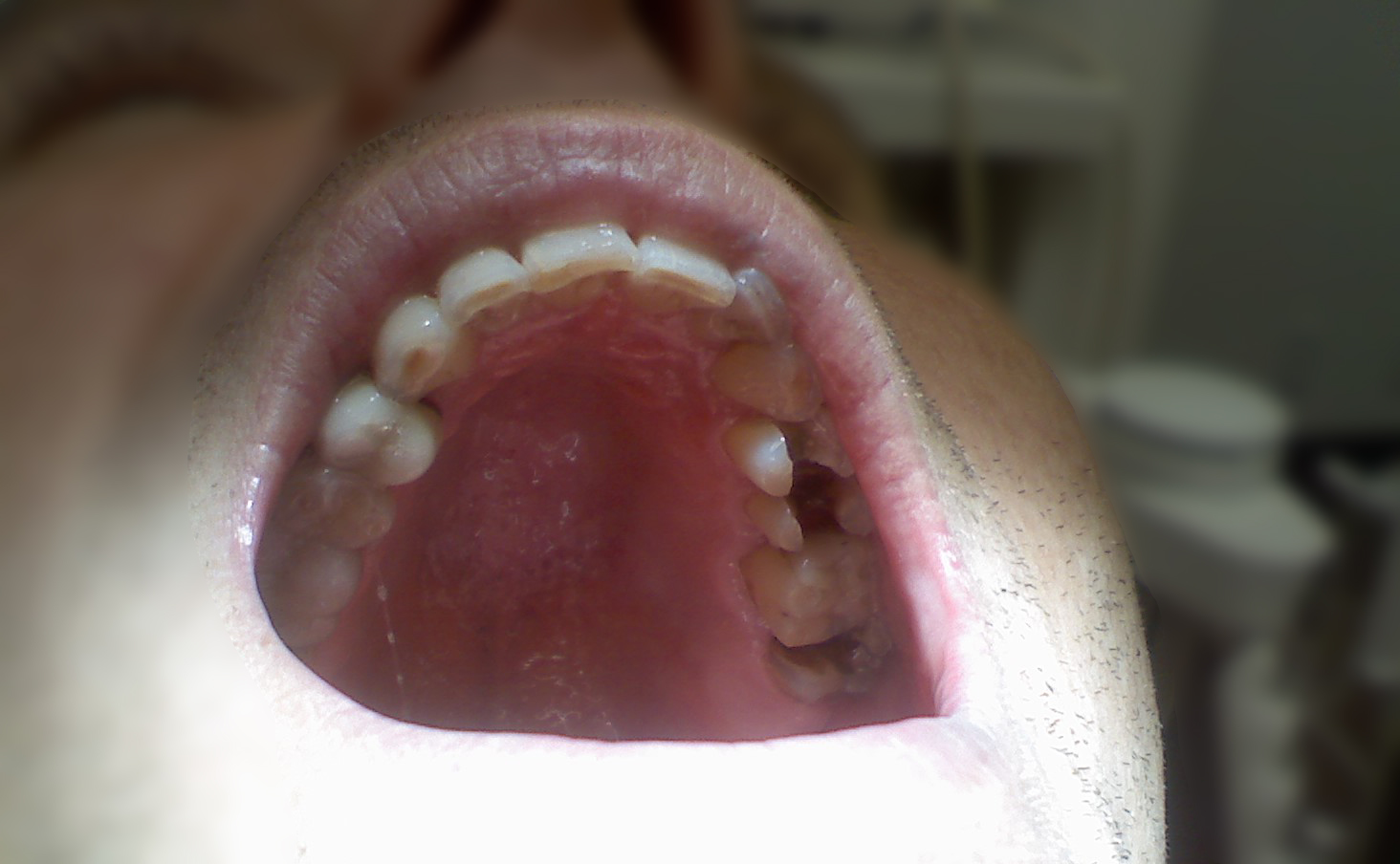 Dental Choices