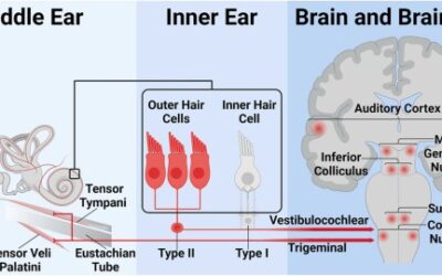 Pain Hyperacusis: What patients say and what audiologists say